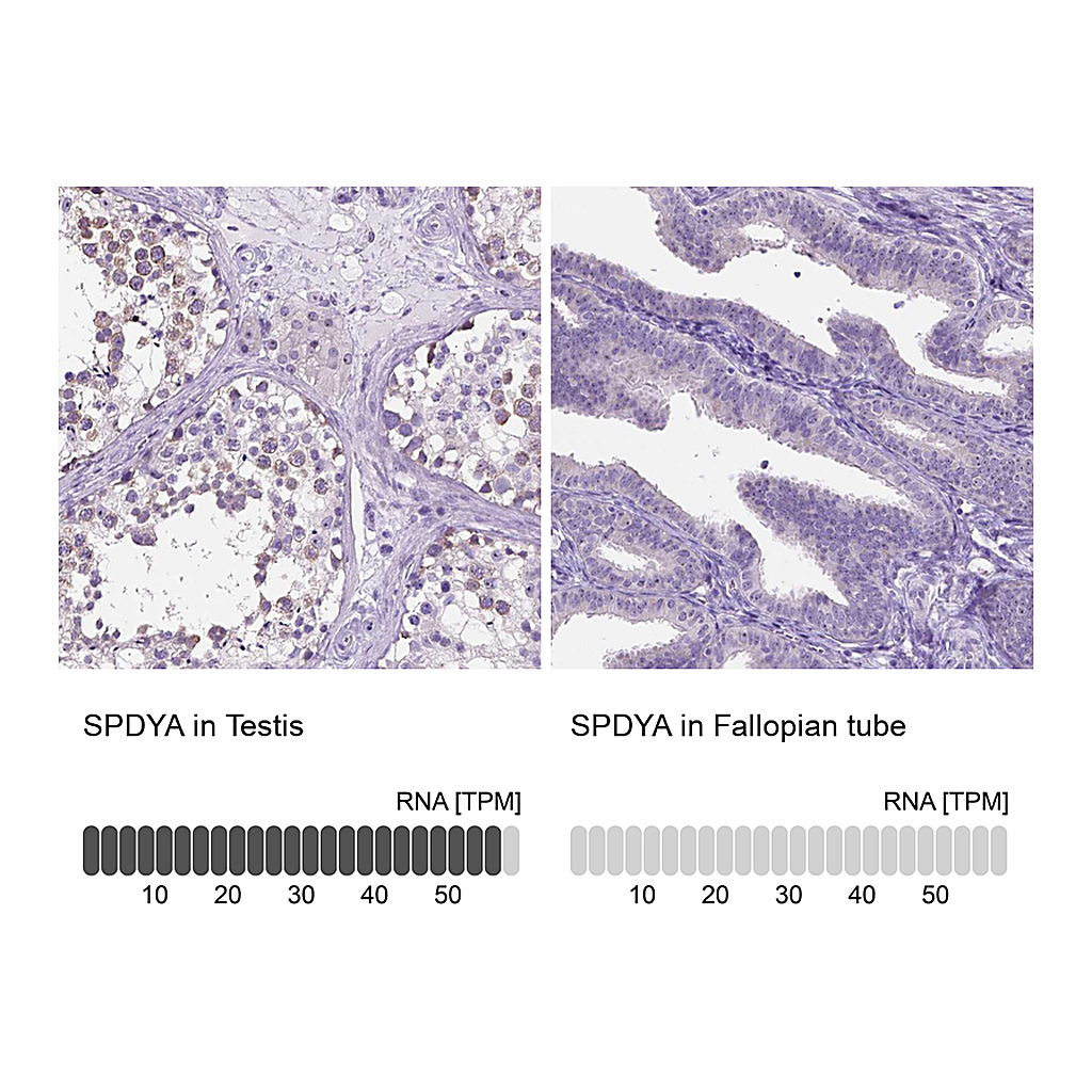 Atlas Antibodies Anti-SPDYA Antibody