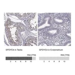Atlas Antibodies Anti-SPDYE4 Antibody