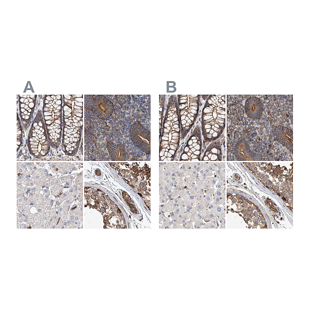 Atlas Antibodies Anti-SPECC1 Antibody