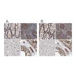 Atlas Antibodies Anti-SPECC1 Antibody