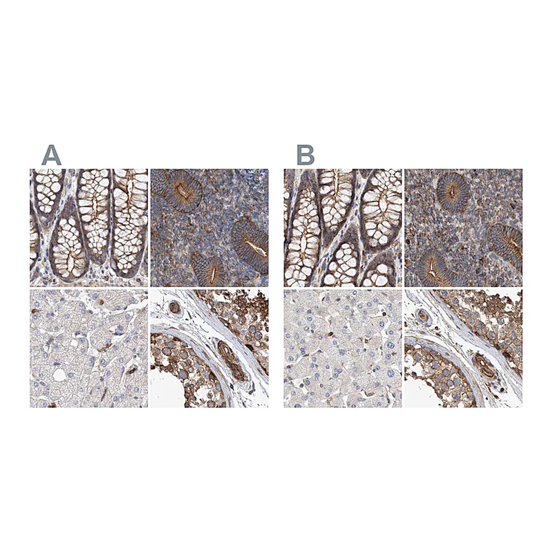 Atlas Antibodies Anti-SPECC1 Antibody