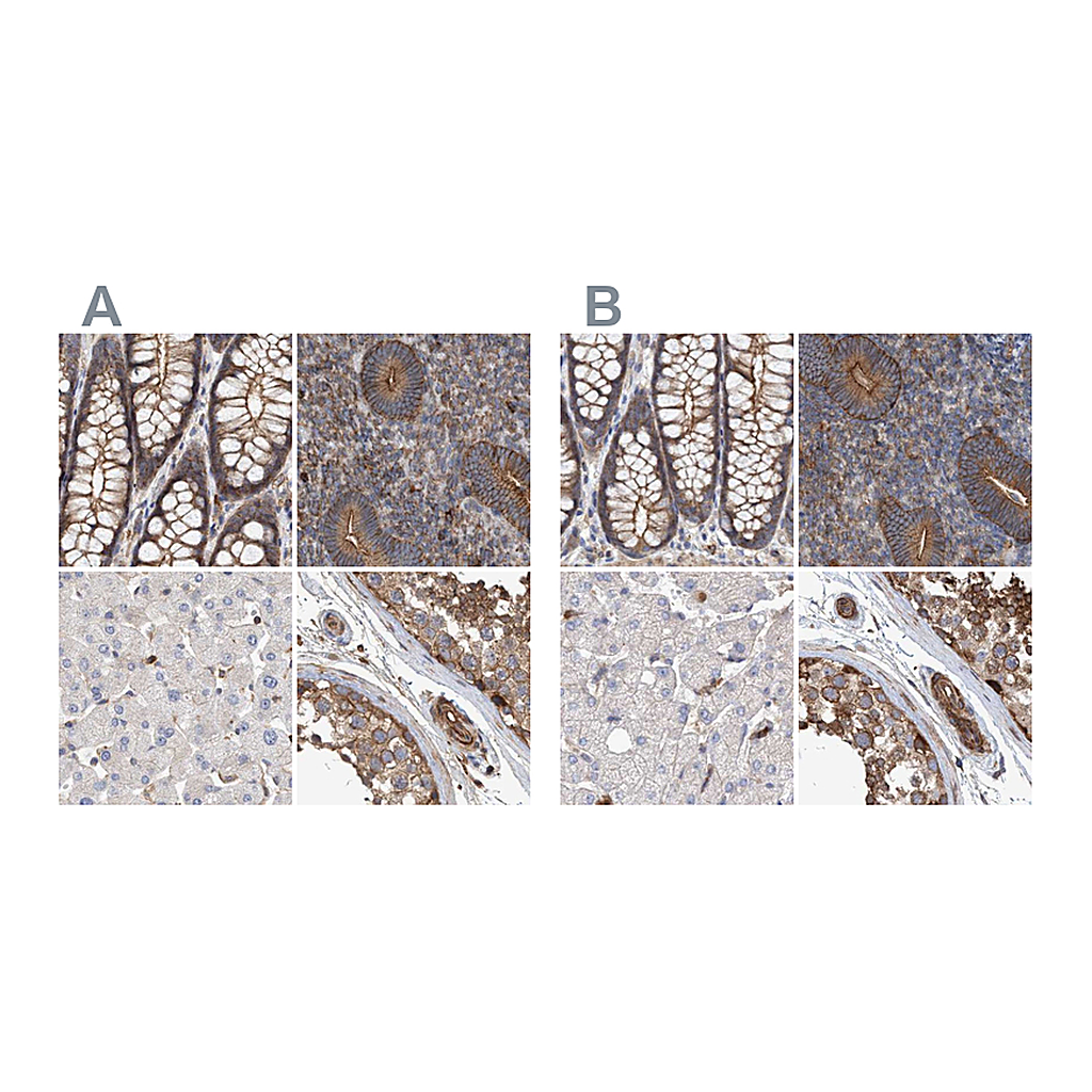 Atlas Antibodies Anti-SPECC1 Antibody