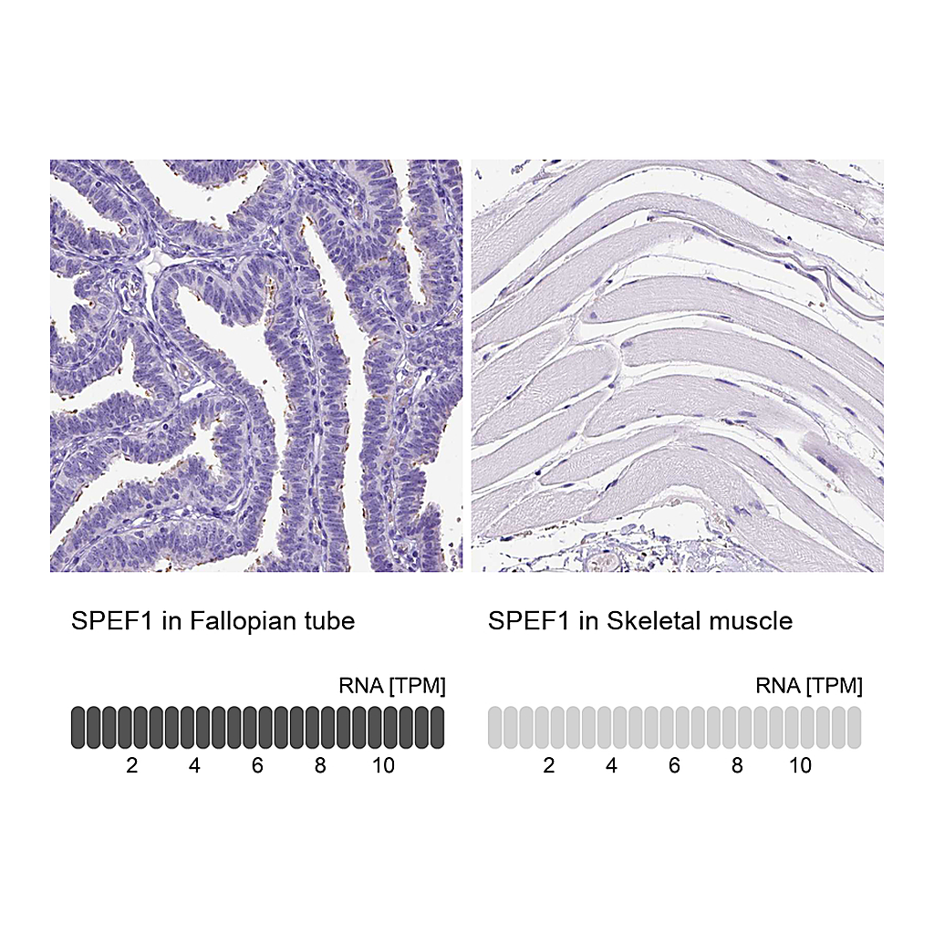 Atlas Antibodies Anti-SPEF1 Antibody