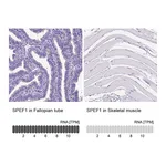 Atlas Antibodies Anti-SPEF1 Antibody