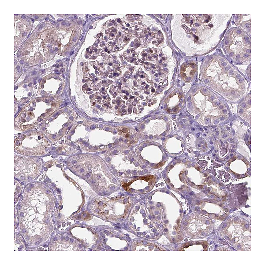 Atlas Antibodies Anti-SPECC1L Antibody