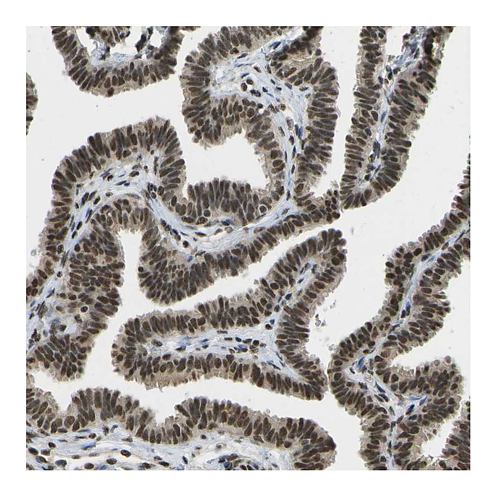 Atlas Antibodies Anti-SPEN Antibody