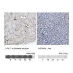 Atlas Antibodies Anti-SPEG Antibody