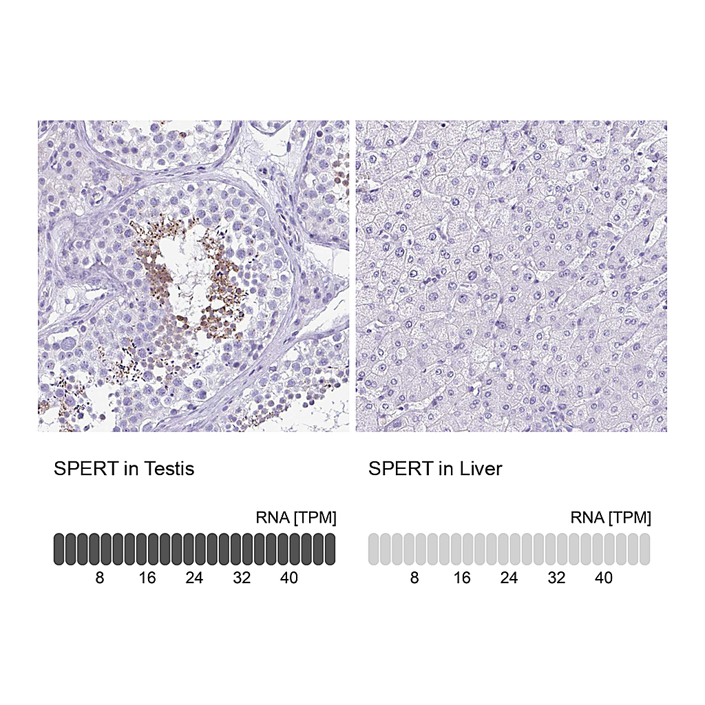 Atlas Antibodies Anti-SPERT Antibody