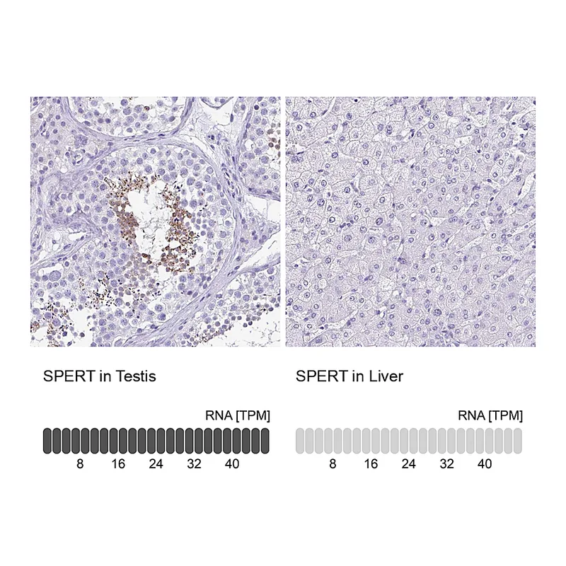 Atlas Antibodies Anti-SPERT Antibody