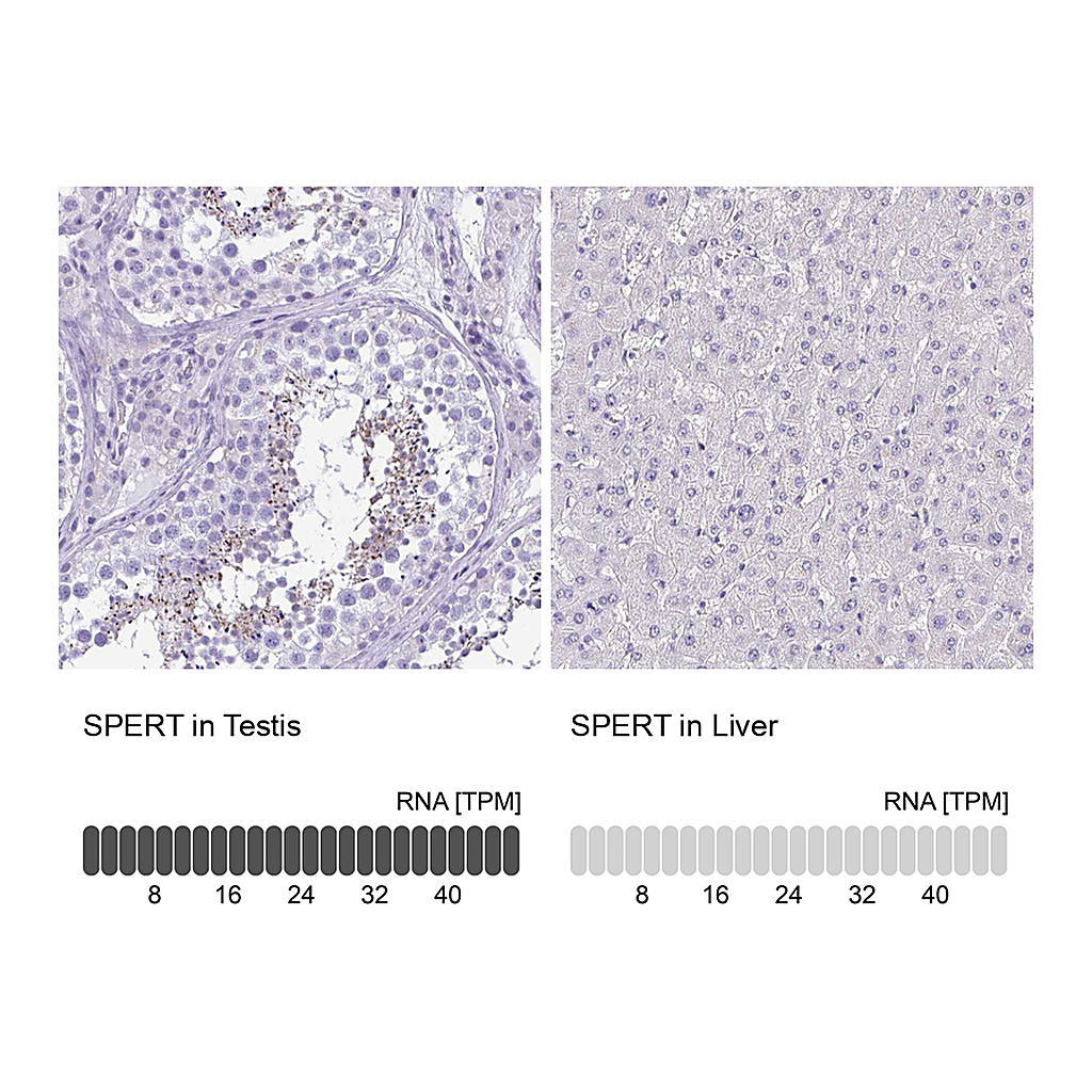 Atlas Antibodies Anti-SPERT Antibody