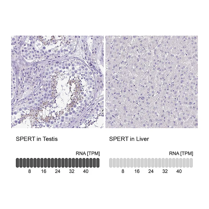 Atlas Antibodies Anti-SPERT Antibody