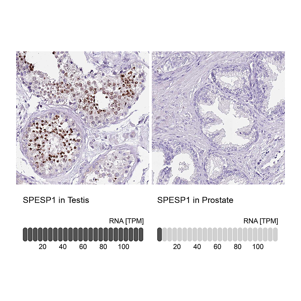Atlas Antibodies Anti-SPESP1 Antibody