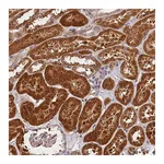 Atlas Antibodies Anti-SPG11 Antibody