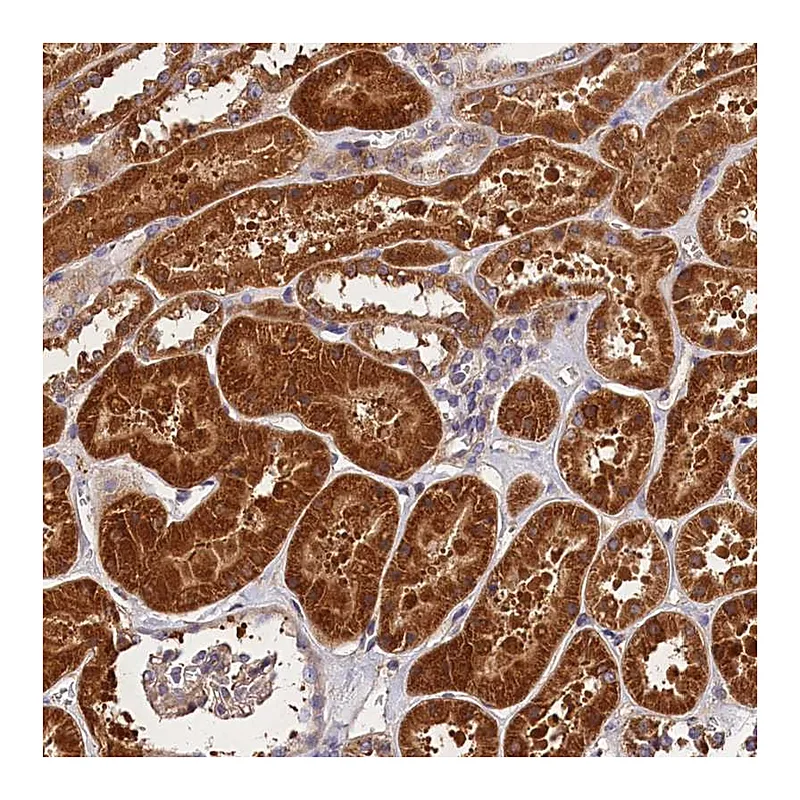 Atlas Antibodies Anti-SPG11 Antibody