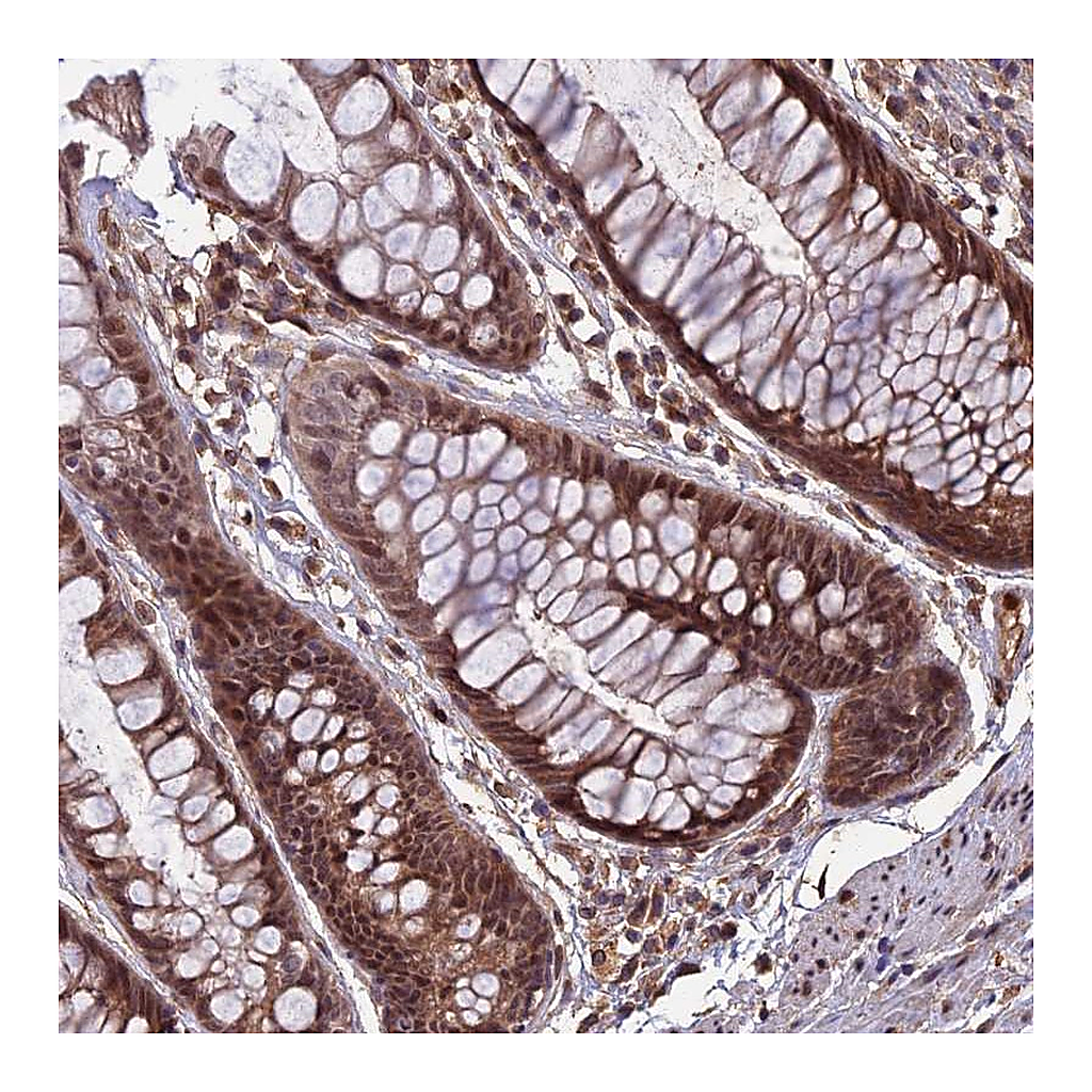 Atlas Antibodies Anti-SPG11 Antibody