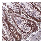 Atlas Antibodies Anti-SPG11 Antibody