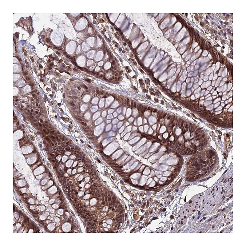 Atlas Antibodies Anti-SPG11 Antibody
