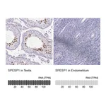 Atlas Antibodies Anti-SPESP1 Antibody