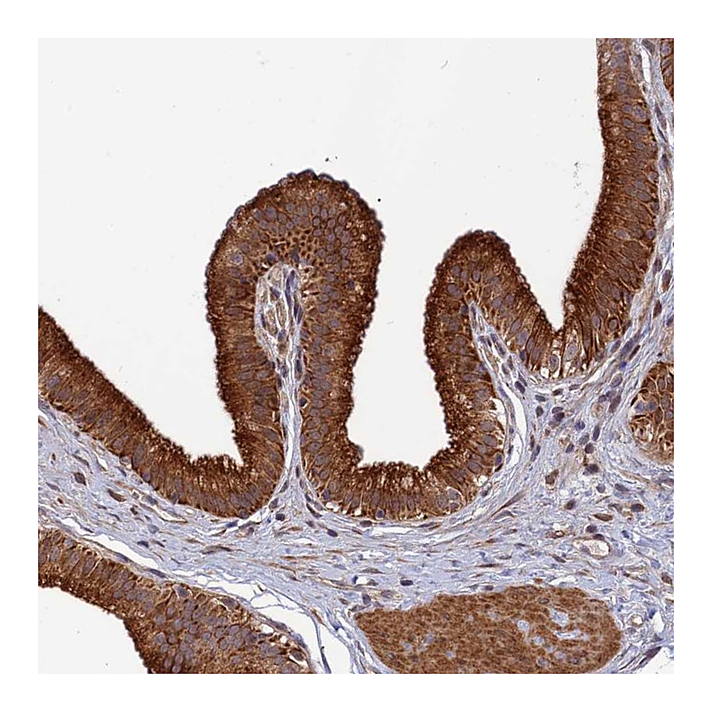 Atlas Antibodies Anti-SPG21 Antibody