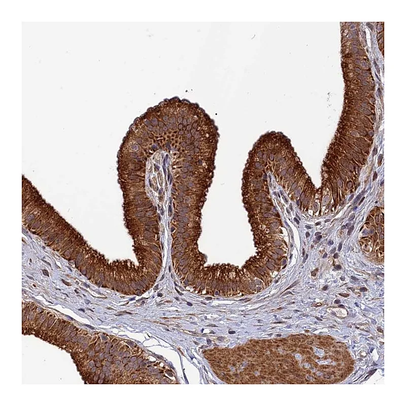 Atlas Antibodies Anti-SPG21 Antibody