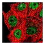 Atlas Antibodies Anti-SPHK2 Antibody