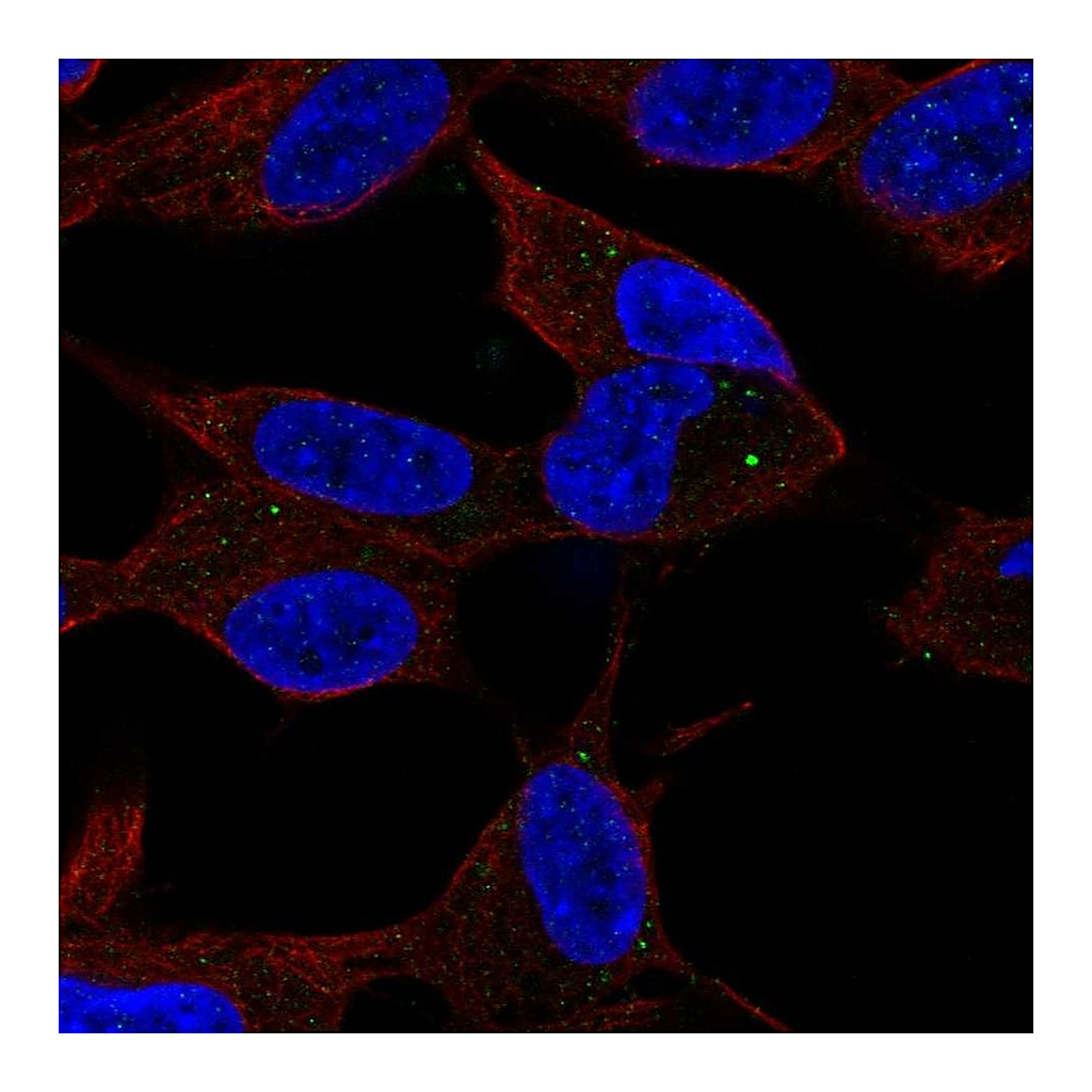 Atlas Antibodies Anti-SPHK2 Antibody