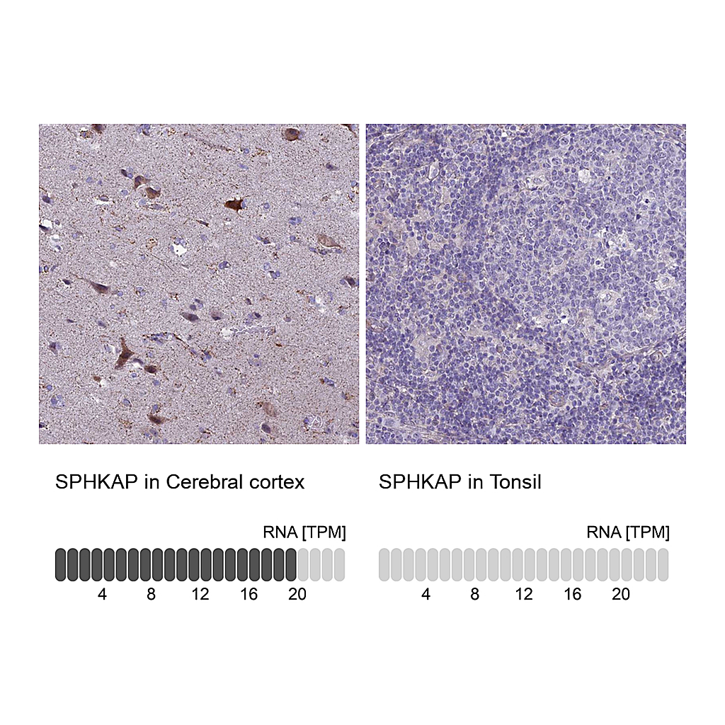 Atlas Antibodies Anti-SPHKAP Antibody