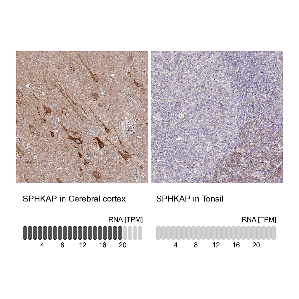 Atlas Antibodies Anti-SPHKAP Antibody