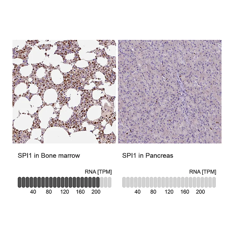 Atlas Antibodies Anti-SPI1 Antibody