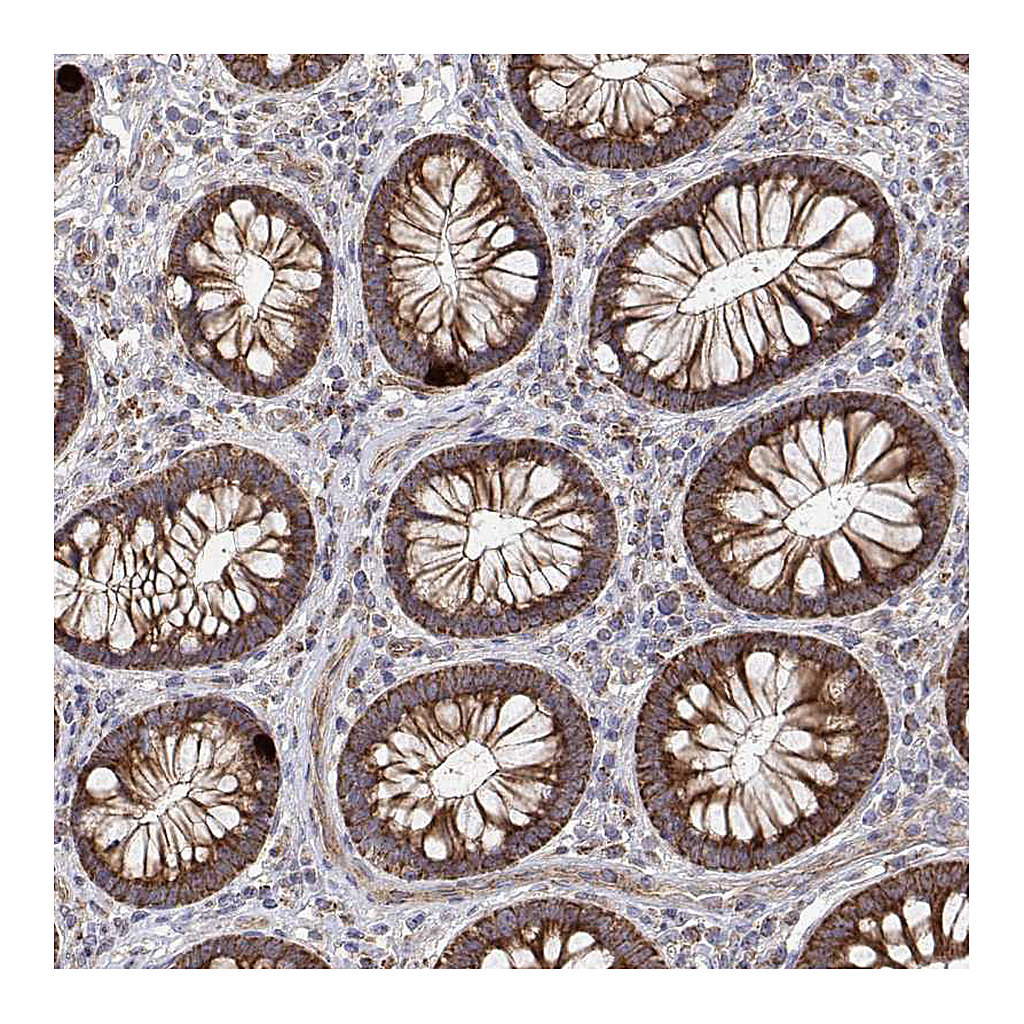 Atlas Antibodies Anti-SPICE1 Antibody