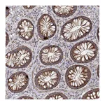 Atlas Antibodies Anti-SPICE1 Antibody