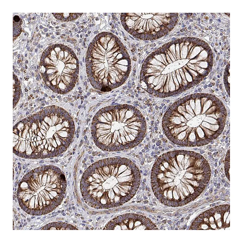 Atlas Antibodies Anti-SPICE1 Antibody