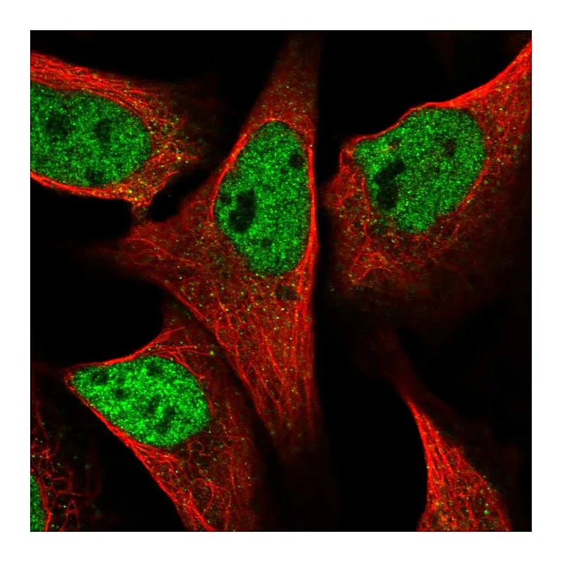 Atlas Antibodies Anti-SPIDR Antibody