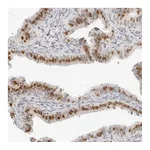 Atlas Antibodies Anti-SPIDR Antibody