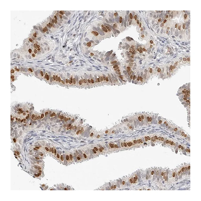 Atlas Antibodies Anti-SPIDR Antibody