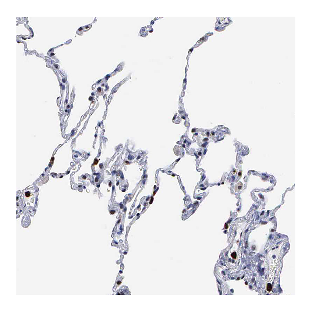 Atlas Antibodies Anti-SPIN3 Antibody
