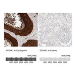 Atlas Antibodies Anti-SPINK2 Antibody