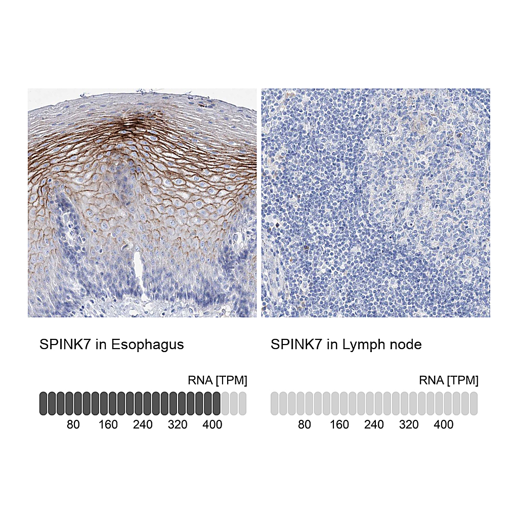 Atlas Antibodies Anti-SPINK7 Antibody