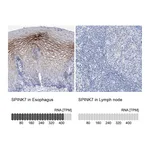 Atlas Antibodies Anti-SPINK7 Antibody