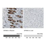 Atlas Antibodies Anti-SPINK4 Antibody