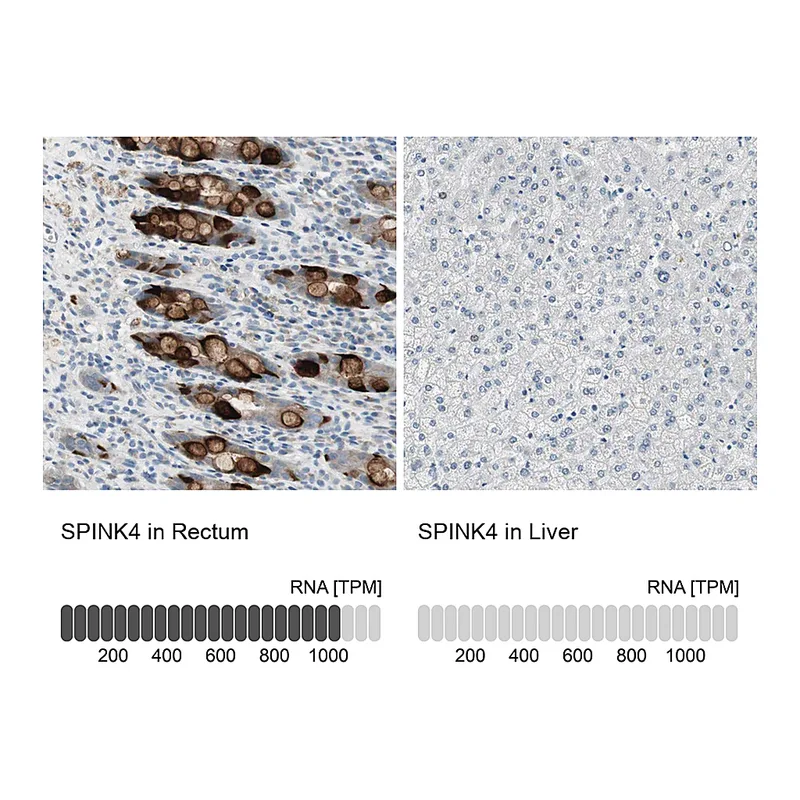 Atlas Antibodies Anti-SPINK4 Antibody