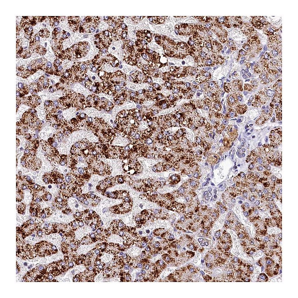Atlas Antibodies Anti-SPINK9 Antibody