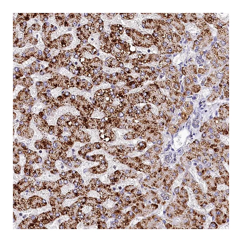 Atlas Antibodies Anti-SPINK9 Antibody