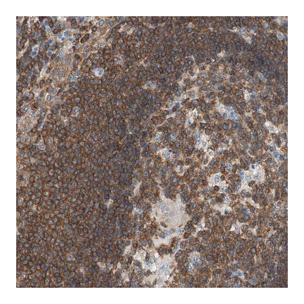 Atlas Antibodies Anti-SPINK6 Antibody
