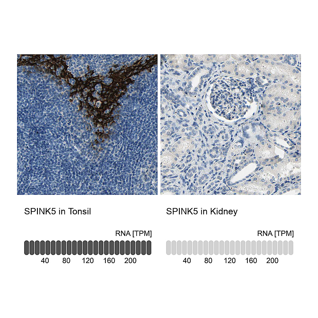 Atlas Antibodies Anti-SPINK5 Antibody