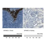 Atlas Antibodies Anti-SPINK5 Antibody