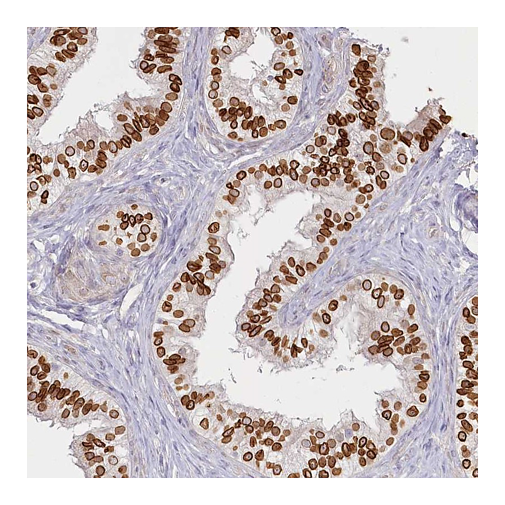 Atlas Antibodies Anti-SPINK13 Antibody