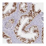 Atlas Antibodies Anti-SPINK13 Antibody