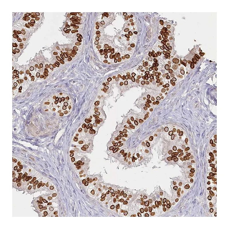 Atlas Antibodies Anti-SPINK13 Antibody