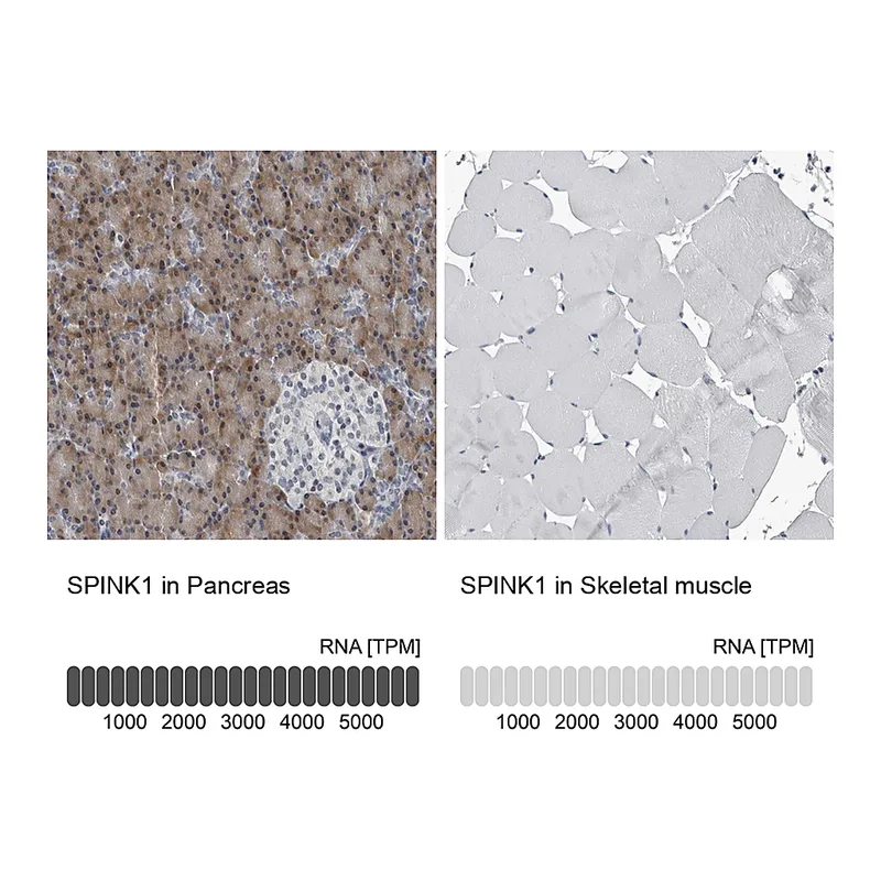 Atlas Antibodies Anti-SPINK1 Antibody